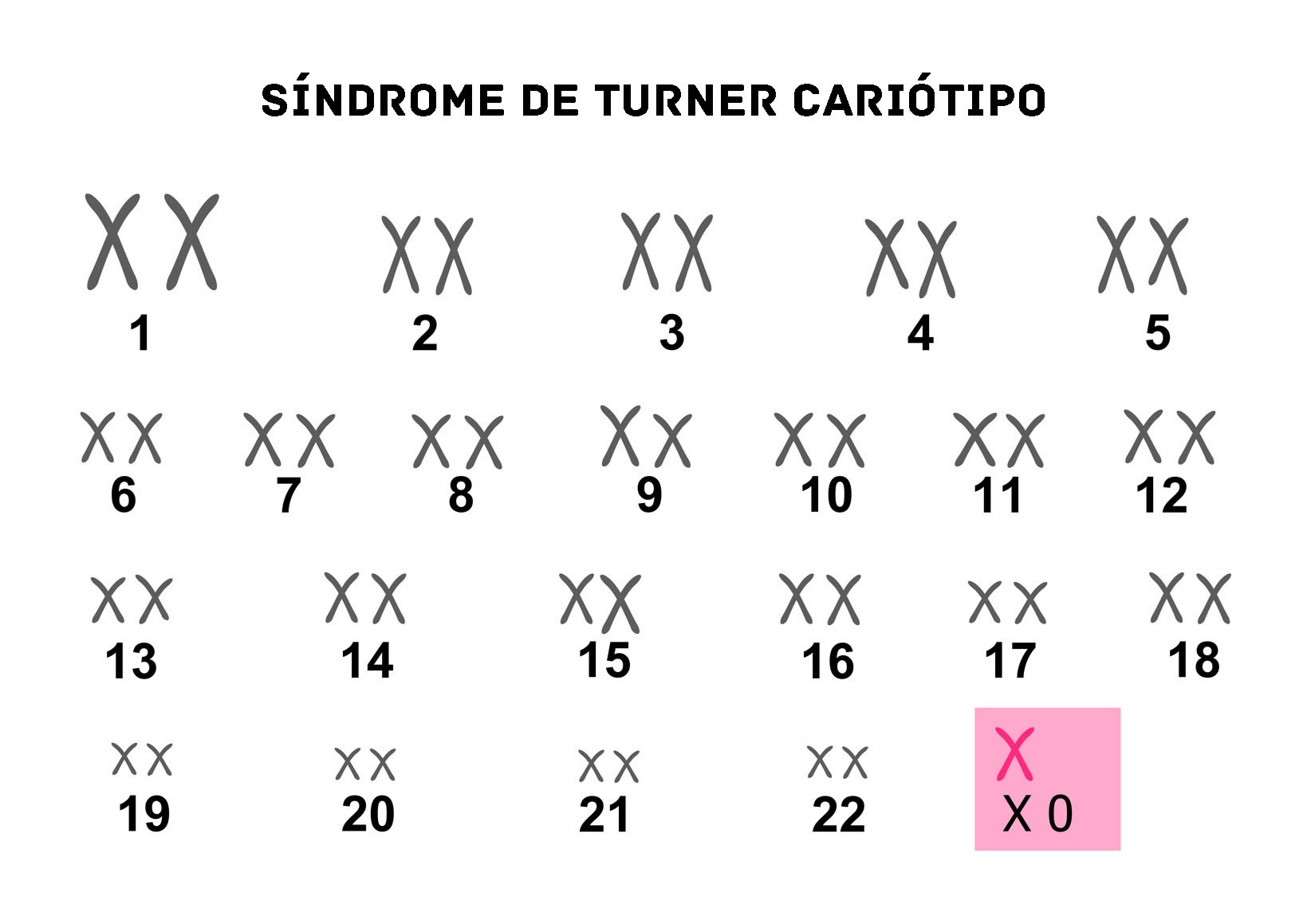 S ndrome De Turner Cromosomas Syndrome De Turner Sch ma M iose GZMY S ndrome De Turner Cromosomas Syndrome De Turner Sch ma M iose GZMY